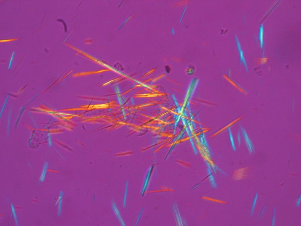 Fluorescent Uric Acid.jpg